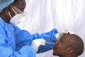 Štúdia WHO priniesla zarážajúce zistenia: V Afrike sa darí odhaliť len zlomok z množstva infikovaných