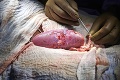 Transplantácia budúcnosti môže zachraňovať životy: Sledujte, ako lekári dali človeku obličku z prasaťa!