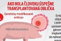 Transplantácia budúcnosti môže zachraňovať životy: Sledujte, ako lekári dali človeku obličku z prasaťa!