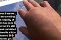 Sexi boxerka ukázala zdeformované ruky: Šesť týždňov po zápase vyzerajú stále otrasne