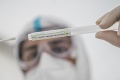 Británia v boji proti koronavírusu: Za uplynulý týždeň eviduje najviac nakazených od júla