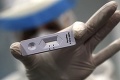 Vláda rozhodla: Slovensko by malo nakúpiť 10 miliónov antigénových testov