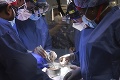 Historický moment! Lekári transplantovali pacientovi srdce ošípanej: Do budúcna môžeme mať nekonečné zásoby orgánov