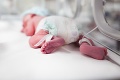 Novorodeniatko vyhlásili za mŕtve: Čo sa stalo o pár hodín neskôr, vám nedovolí zaspať