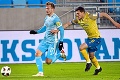 Futbalista Slovana Medveděv mal na Silvestra úraz: V Estónsku takmer prišiel o oko