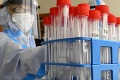 Uplynulý týždeň pribudlo 40 751 osôb s pozitívnym PCR testom: Najviac ich bolo v tomto kraji