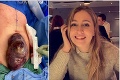 Neuveríte vlastným očiam: Lekári jej tvrdili, že je v poriadku, potom jej z tela vybrali nádor veľkosti melóna!