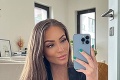 Česká influencerka už viac neskrýva jazvy: Týnuš prehovorila o ťažkej ceste po hororovej nehode