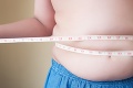 Obezita výrazne prispieva k rozvoju ďalších ochorení: Spôsobuje väčšiu úmrtnosť ako následky fajčenia!