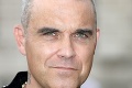 Kde sú jeho husté vlasy? Robbie Williams sa zmenil viac, než sa zdá: Zvažuje zúfalý krok!