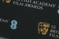 Ceny BAFTA sú rozdané! Dychvyrážajúce róby aj poriadne výstrelky: Sledujte, v čom prišli celebrity