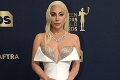 Lady Gaga ako ju vidíme len zriedka: Dala prednosť pohodliu