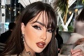 Influencerka trpko doplatila na svoju krásu: Kvôli umelým nechtom prežila najhoršiu noc v živote!