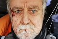 Švajčiarsky novinár zažil na Ukrajine najväčšiu hrôzu života: Z jeho opisu tuhne krv v žilách!