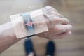 Nová nádej pre pacientov s Parkinsonom – smart hodinky