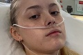 Zdravotné problémy dievčaťa (20) lekári pripisovali častému žúrovaniu: Teraz bojuje o holý život
