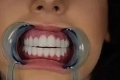Nechala si urobiť nové krásne zuby, teraz sa jej smejú: Hrozné, čoho sú schopní ľudia na internete