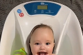 Bábätko sa vďaka zriedkavej poruche stalo hviezdou internetu: Vyzerá, akoby sa stále usmievalo