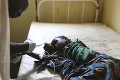 Ľudí v africkej krajine márni infekčná choroba: O život už pripravila množstvo osôb