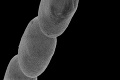 Vedci odhalili najväčšiu baktériu na svete: Tomu nebudete veriť, zaskočení sú i odborníci