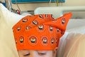 Z hrče na hlave sa vykľula zriedkavá rakovina: Malý chlapec musel absolvovať už 30 chemoterapií
