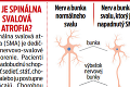 Statočného Dominika trápi zákerné ochorenie: Kto odmietol dať chlapcovi šancu na záchranu života?