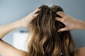 Vlasy sú korunou krásy, veľa však prezrádzajú aj o zdraví: 6 vážnych problémov, ktoré môžu indikovať