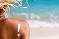 Niektoré typy kože sú na slnko citlivejšie: Lekári radia, kto by sa mu mal úplne vyhnúť