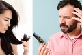 6 vecí, ktoré o vás môžu prezradiť vaše vlasy: Od problémov so štítnou žľazou až po stres!