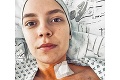 Patrícia Janečková podstúpila kvôli rakovine mastektómiu: Čo ju čaká po odstránení prsníka?