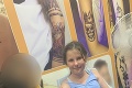 Rodičia, pozor! Mamička varuje pred tetovaním henou: Ruka jej dcéry teraz vyzerá hrozne