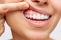 Zuby o vás môžu povedať viac, než chcete: Existuje 5 najdôležitejších znakov, čo prezrádzajú?