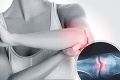 MBST terapia: Unikátna liečba kĺbov odstráni nielen bolesť, ale aj jej príčinu