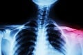 MBST terapia: Unikátna liečba kĺbov odstráni nielen bolesť, ale aj jej príčinu