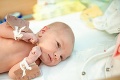 Rodičia! Pri malých bábätkách je získať istotu z troch kvapiek krvi výhra!