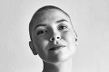 Speváčka Janečková po náročnej liečbe rakoviny: Ešte stále to nie som ja!