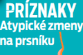 Nález vystrašil aj Ďuriš Nicholsonovú: Ako sa vyhnúť rakovine prsníka? Rezort zverejnil zarážajúci údaj