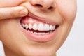 Takmer polovica ľudí na svete má problémy so zubami! Toto sú tie najčastejšie: WHO vyzýva štáty