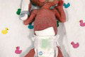 Dvojička zachránila život svojej sestre: Núdzové volanie z tehotenského bruška! Toto lekári ešte nevideli