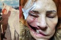 Peklo v živote Slovenky Oľgy: Jej tvár požiera záhadný parazit! Rodina je zúfalá, lekári bezradní