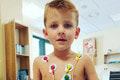 Chlapček trpí zriedkavým ochorením, o hrách s deťmi len sníva: Namiesto srdcovej chlopne má čosi iné