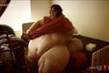 Extrémne tučná žena schudla 180 kíl: Všetko odštartovala baktéria, ktoré požiera mäso
