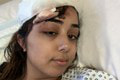 Žena mala počas havárie vo vlasoch štipec: Katastrofálne následky, začal sa boj o život