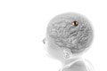 Musk bude testovať mozgové implantáty na ľuďoch: Tento muž vďaka nim po 12 rokoch opäť chodí