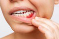 Starostlivosť o zuby nikdy nepodceňujte: Zubári varujú, hrozí vám 5 smrteľných zabijakov!