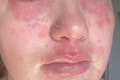 Žena ukrutne trpí pri každej návšteve svojho frajera: Môže za to záhadná alergická reakcia?!