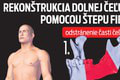 Jedinečný zákrok chirurgov v Bratislave: Mladíkovi s nádorom zachránili tvár! Neuveriteľné, čím mu nahradili čelusť