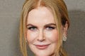 Čo sa to s hviezdnou herečkou stalo? Nicole Kidman ukázala postavu: Veď to je extrém!