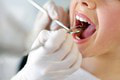 Nechutné, čo sa deje vo vašich ústach, ak si neumyjete zuby: Uf! Utekajte pre kefku