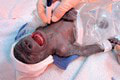 Gorila rodila cisárskym rezom: Gynekologička v šoku z toho, čo TAM videla!